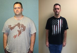 Anthony Hockensmith Before and After Gastric Bypass Surgery